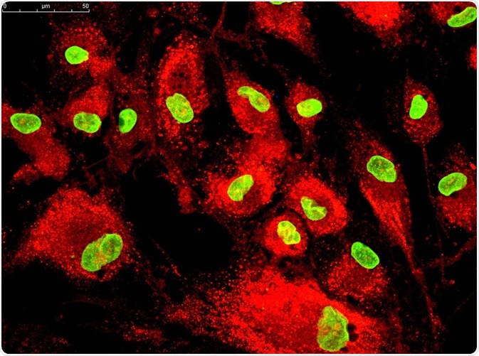 What are Stromal Cells (Mesenchymal Stem Cells)?