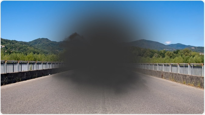 Macular Degeneration Symptoms