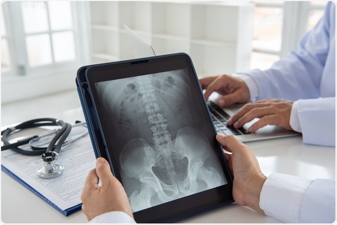 What is Teleradiology?