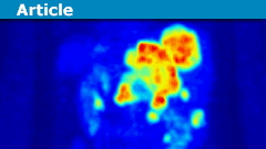 Learn the Basics of Positron Emission Tomography (PET)