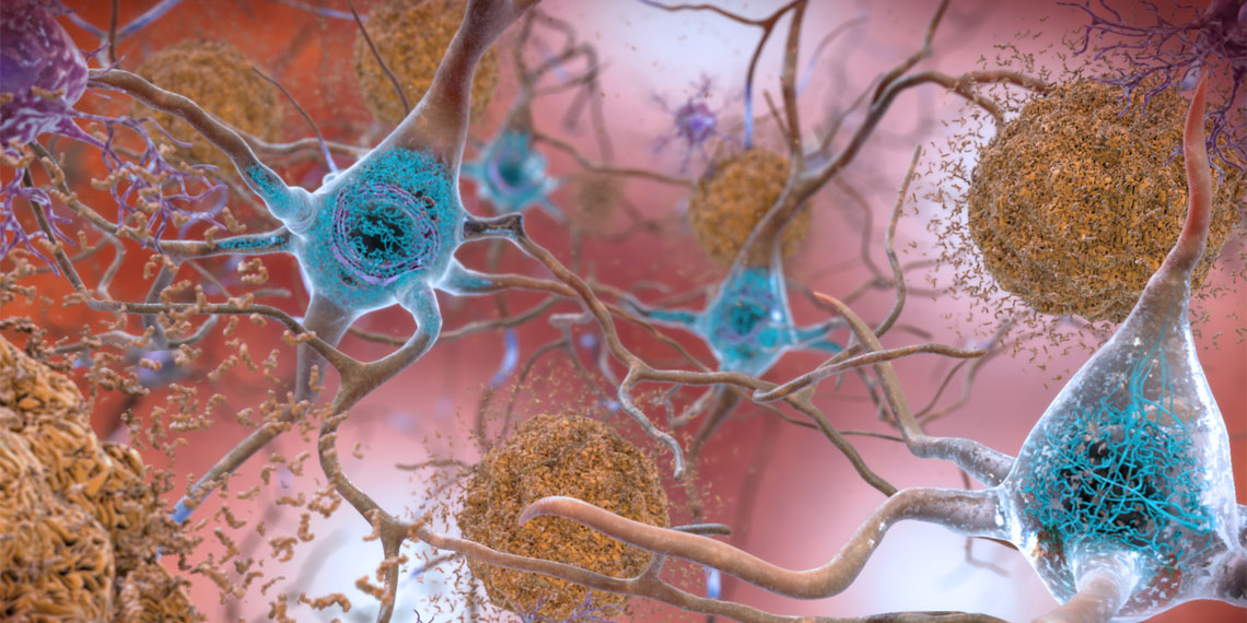 New research in mice suggests Alzheimer's disease is linked to circadian rhythm