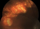‘Doctor, I Have Mountains in My Eyes’
