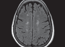 Seeking Sarcoidosis