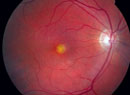 Pearls on Proper Use of Retinal Imaging