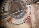 Rethinking Endothelial Repair