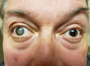 Bad Pupil