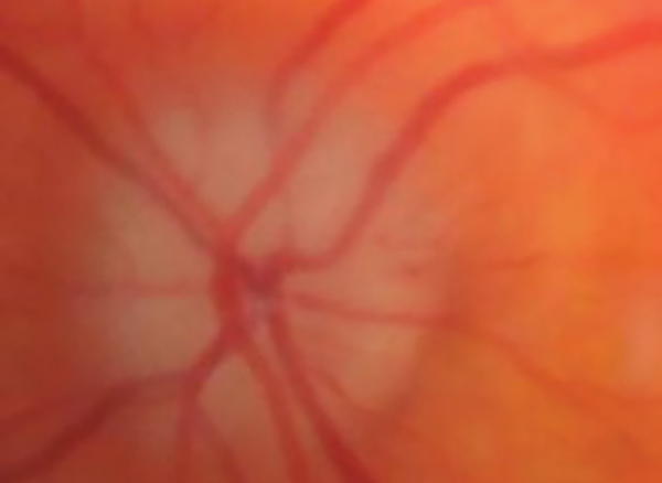 Practical Neuro-Ophthalmic Disease Management