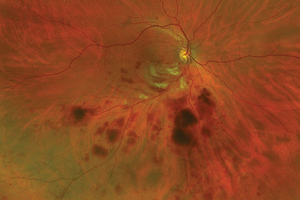 The Road to Retina Specialization