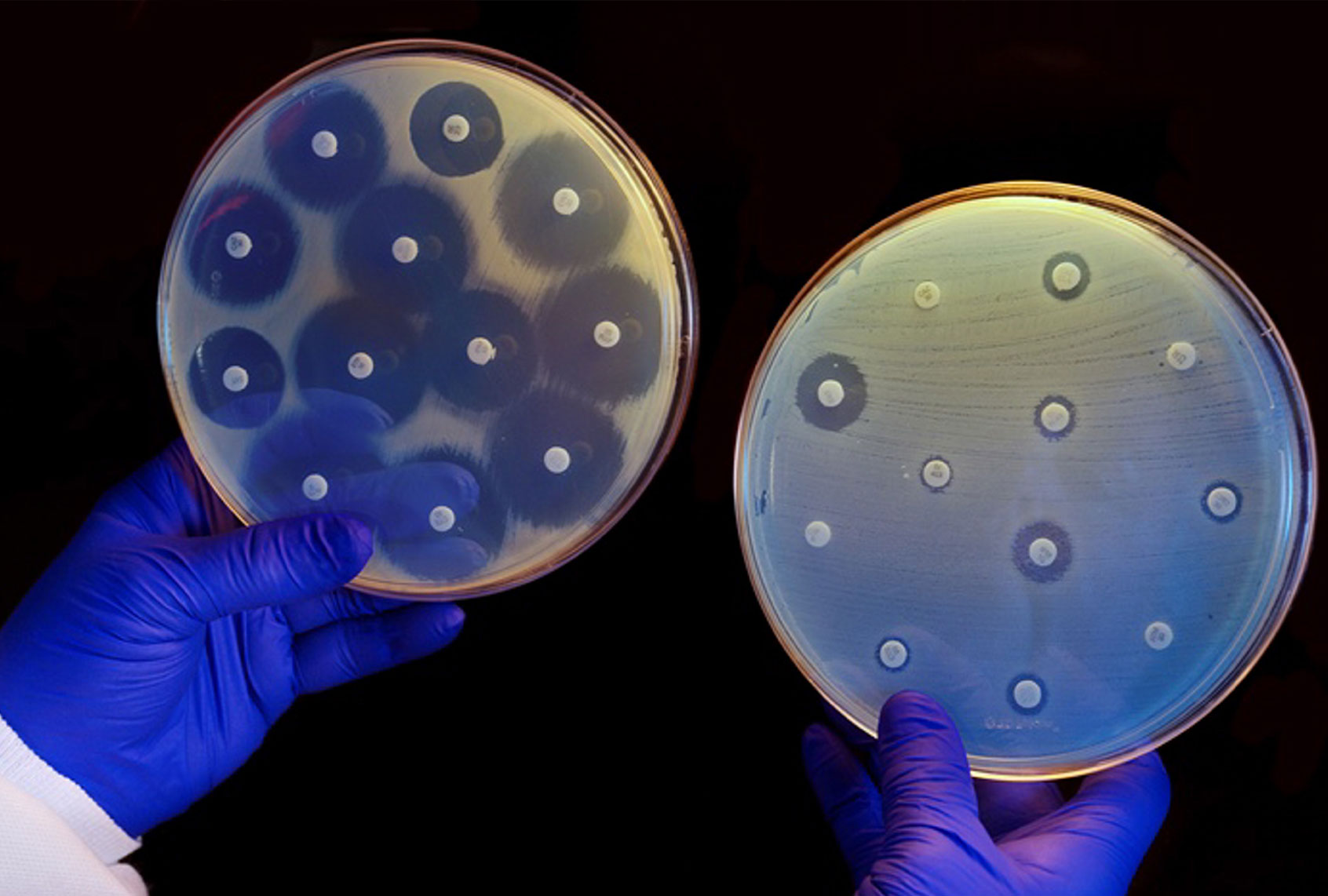 As Big Pharma loses interest in new antibiotics, infections are only growing stronger - Salon.com
