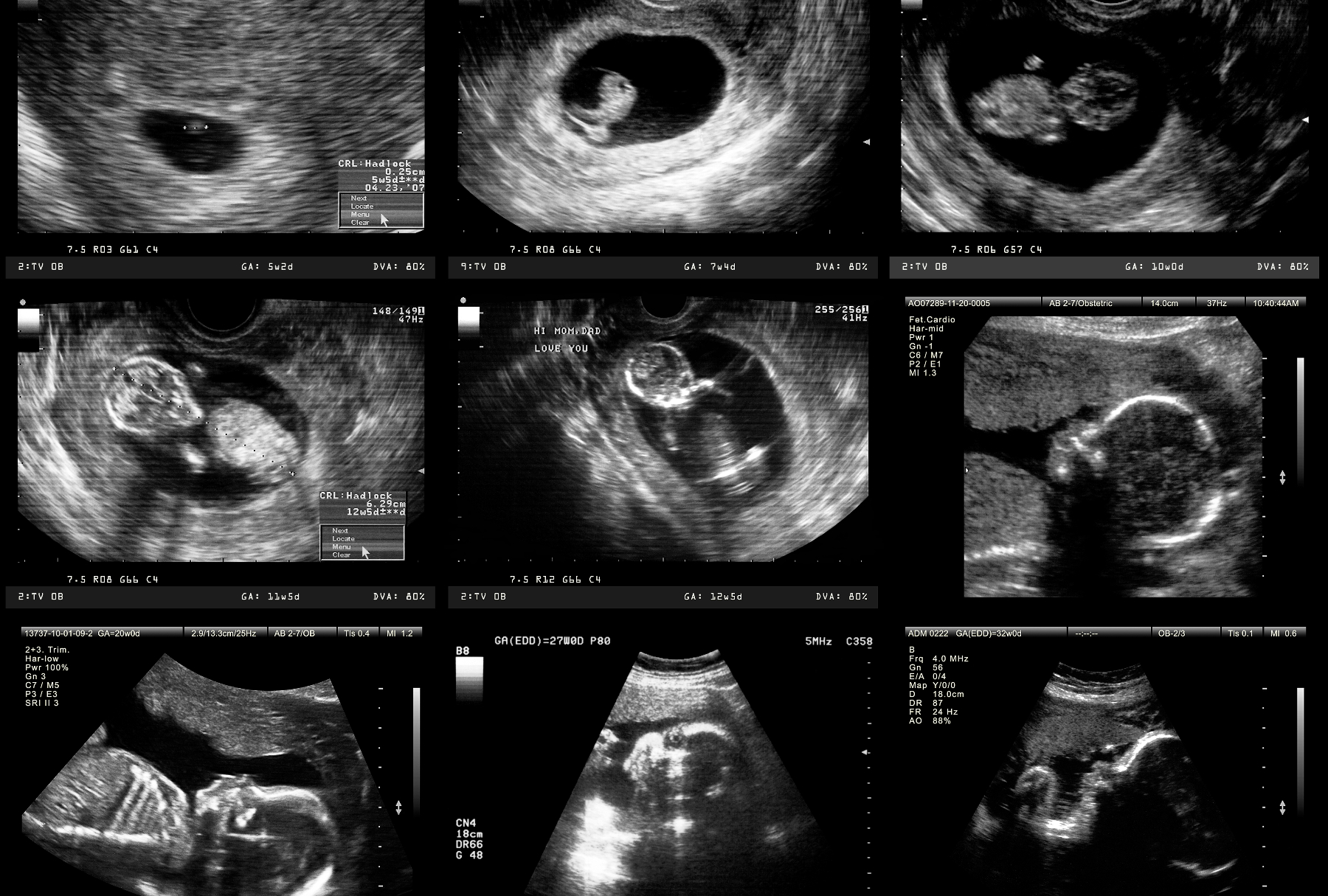 When human life begins is a question of politics — not biology - Salon.com