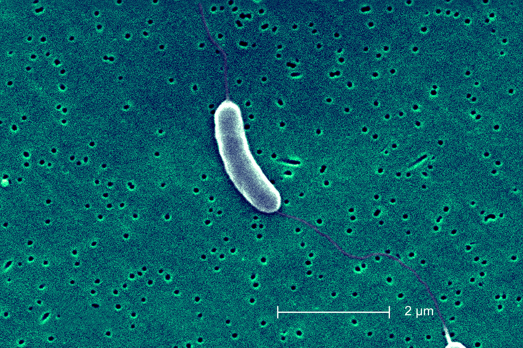 Flesh-eating bacteria infections are on the rise in the U.S. A biologist explains how to stay safe - Salon.com