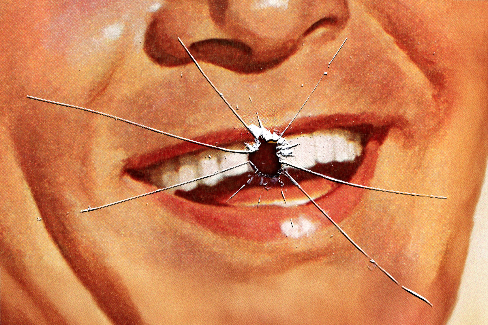 15 years ago I got veneers — now my teeth keep falling out - Salon.com