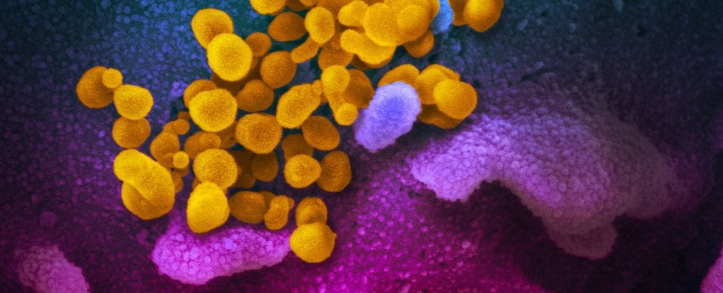 This Is What The COVID-19 Virus Looks Like Under The Microscope : ScienceAlert