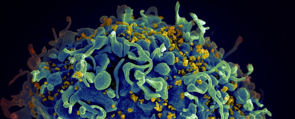 Cancer Drug Flushes Out Latent HIV, Exciting New Study Finds : ScienceAlert