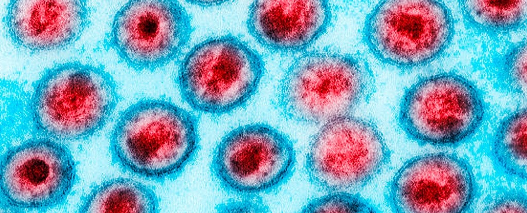 American Woman Appears To Be Entirely Cured of HIV After Unique Medical Treatment : ScienceAlert