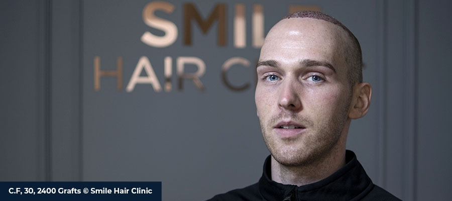Smile True Philosophy - Smile Hair Clinic