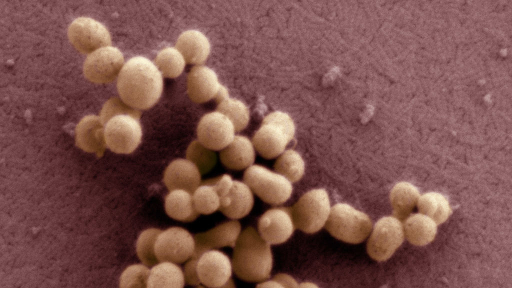 A lab-made cell shows why ‘disease genes’ are so elusive