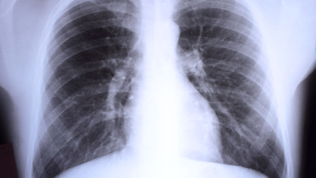 Why Brigham and Women's Hospital is blogging about its mistakes