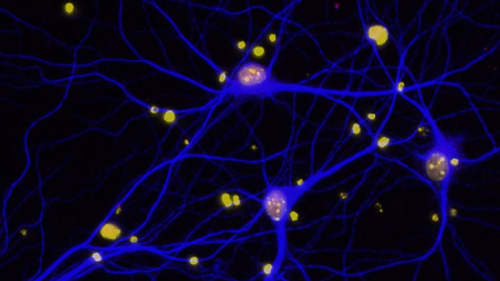 Tinkering with mellow messenger in the brain may yield new drugs