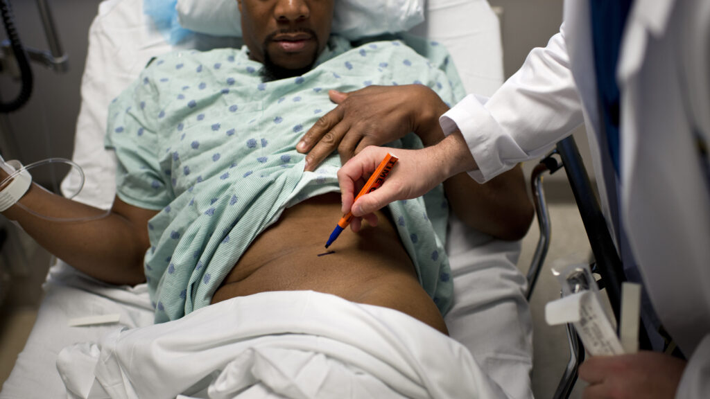 Reforming organ transplant systems will save lives and money | STAT