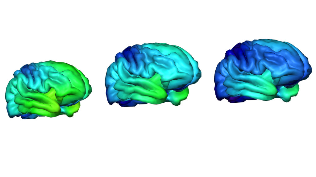 This study could unlock the mysteries of teen brain development