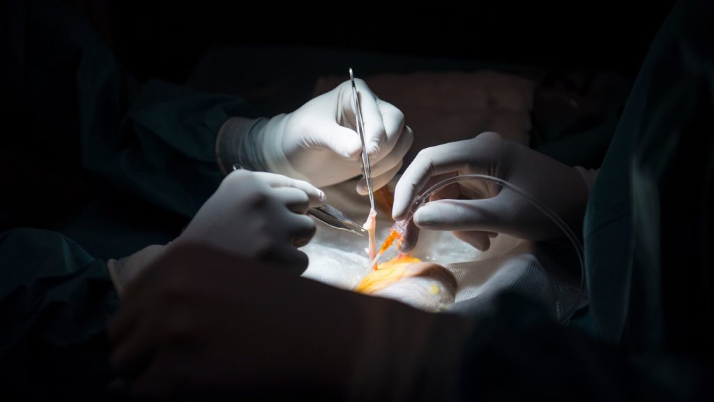 Access to donated organs is becoming more equitable. More work must be done