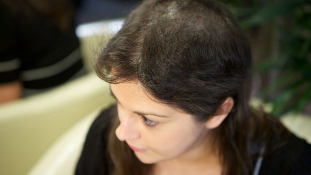 My trichotillomania could be solved with a precision medicine approach