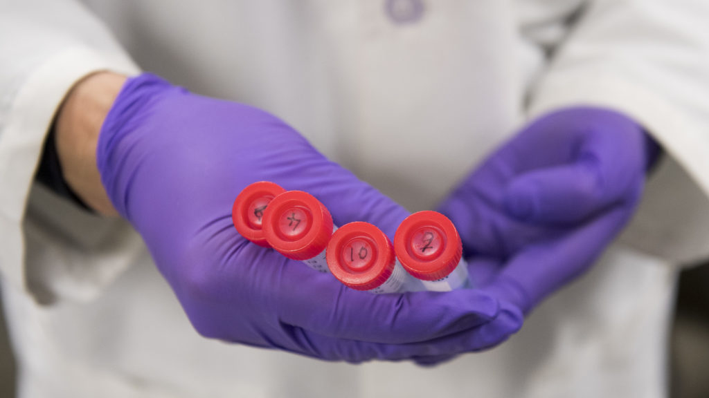 The clinical and ethical challenges of Alzheimer’s blood tests| STAT