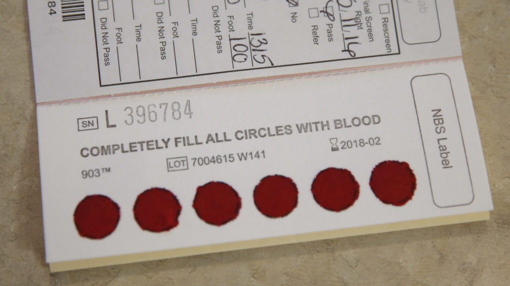 Delays in adding new newborn screening tests harm babies, families