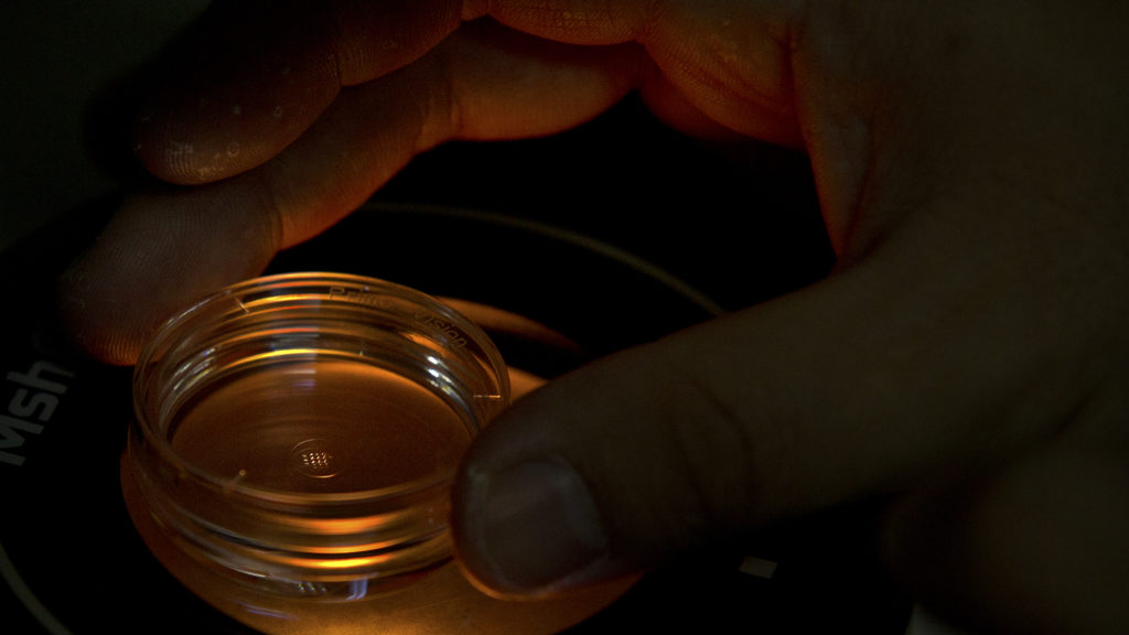 Poll: Americans support gene-editing embryos to prevent diseases | STAT