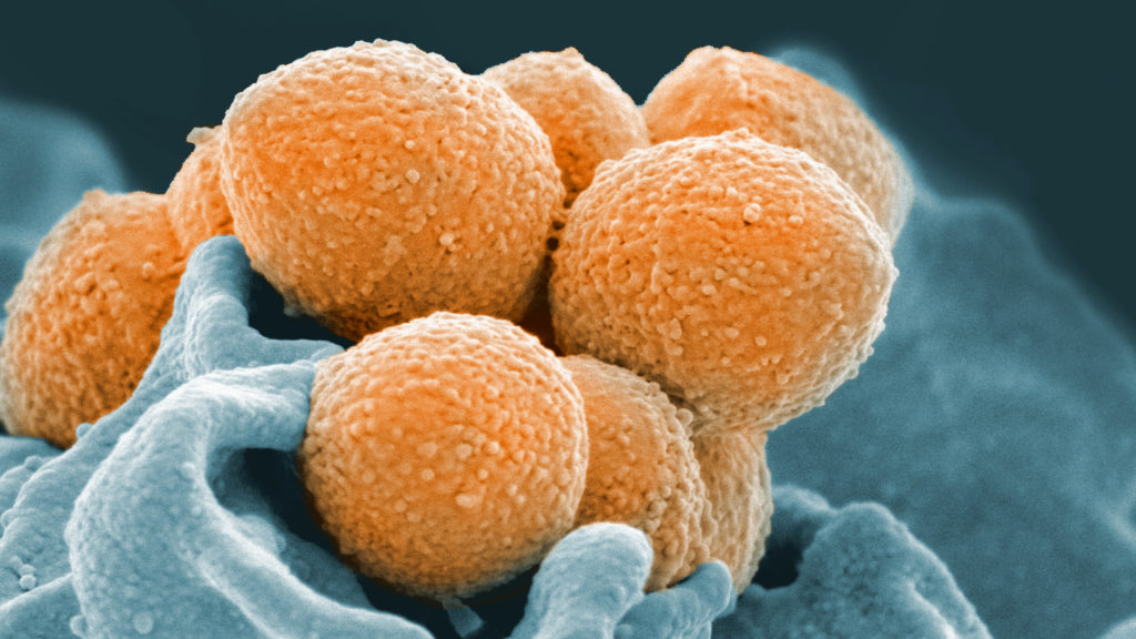 'Neglected dieases' need a voice for leadership and funding | STAT