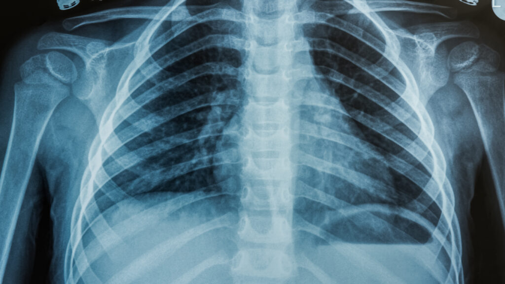 Advancing AI in health care: it's all about trust | STAT