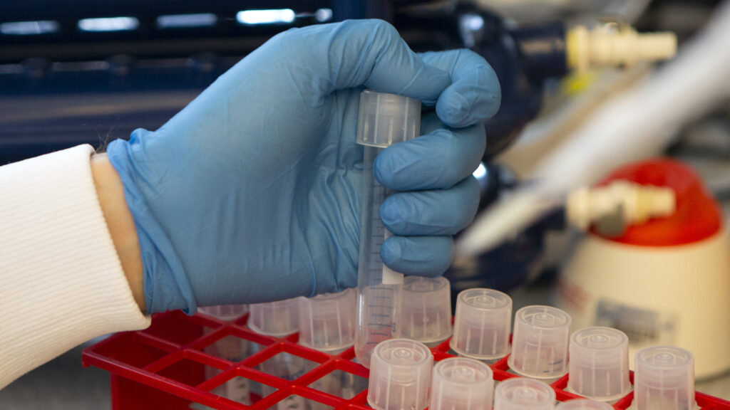 Antibody drugs could be key tools against Covid-19. But will they matter?