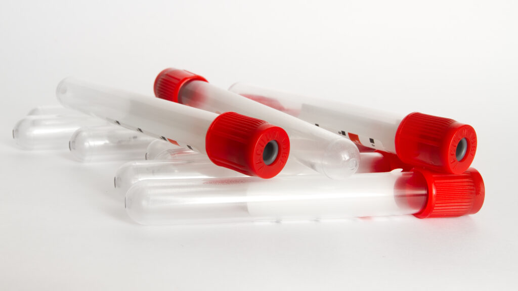 Thrive blood test can help detect cancer early in otherwise healthy people