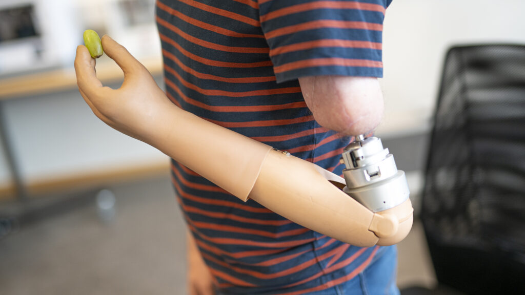 Prosthetic arm enables patients to feel the objects they grip | STAT