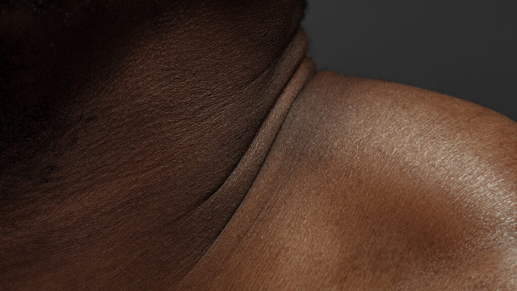 To begin addressing racial bias in medicine, start with the skin | STAT