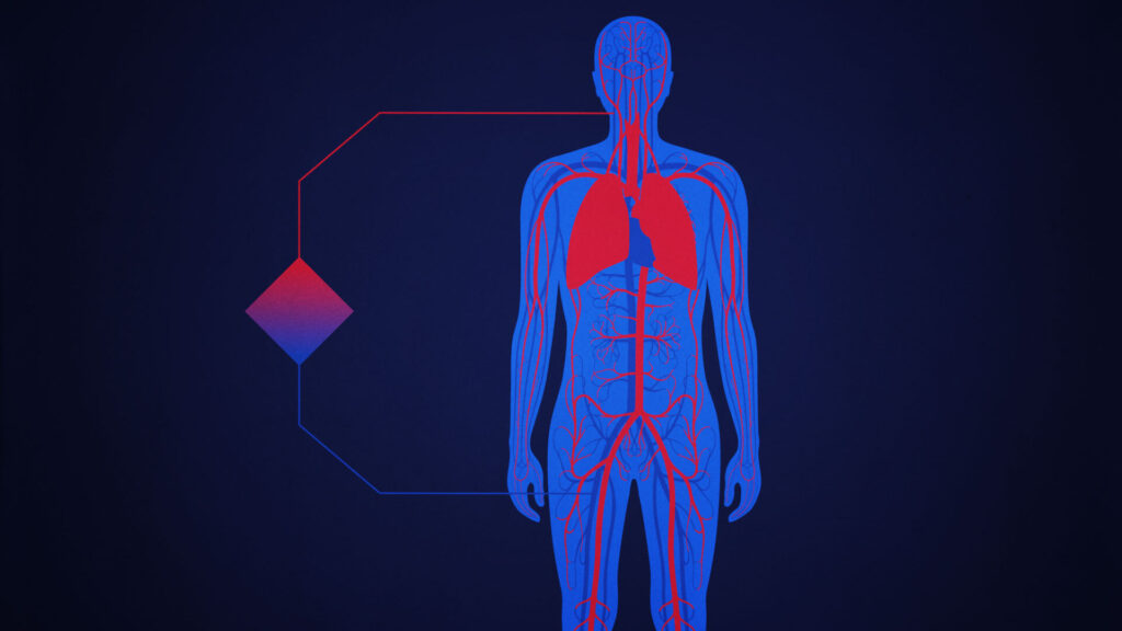 How a Zoom forum is changing ICU treatment of Covid-19 patients | STAT