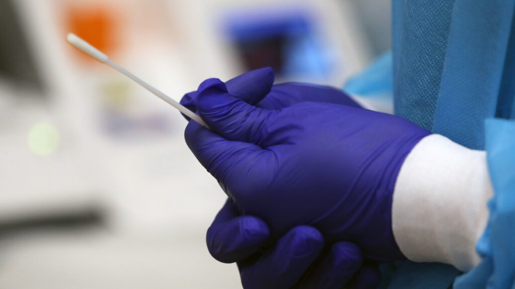 Fast, low-cost coronavirus testing can avert a new Covid-19 wave | STAT