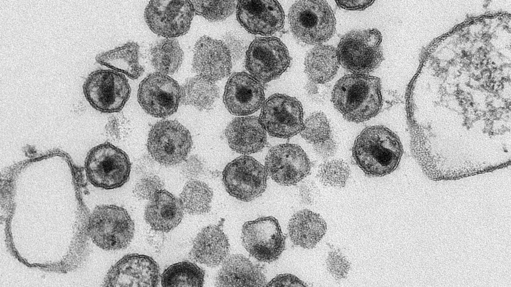 Rates of HIV infection among Black, Hispanic men unchanged in 10 years