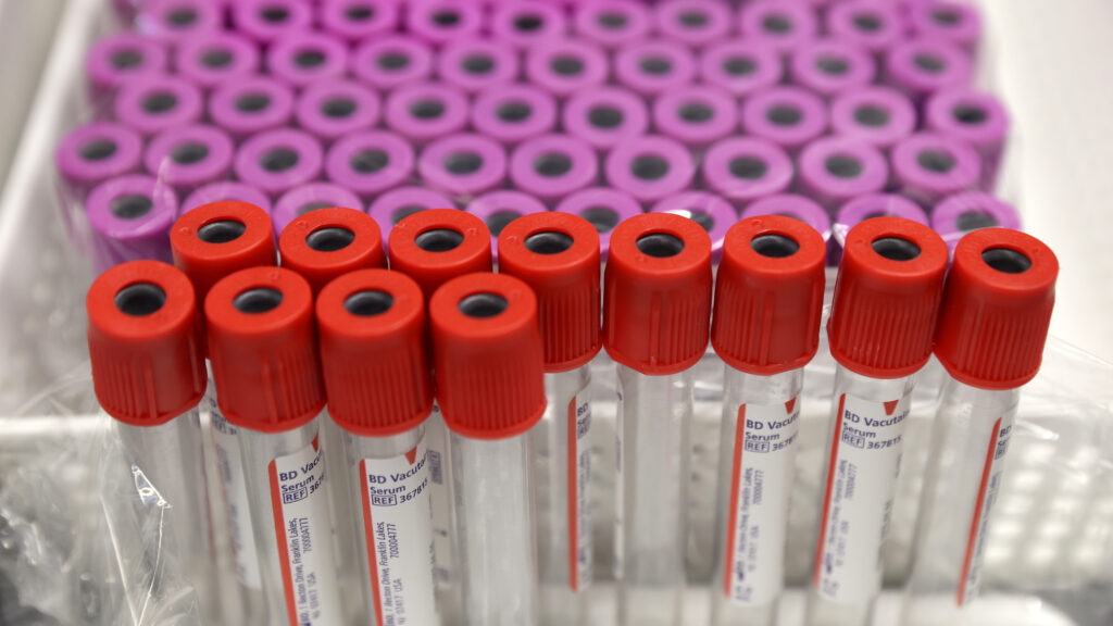 Removing an FDA donation ban would ease the U.S. blood shortage