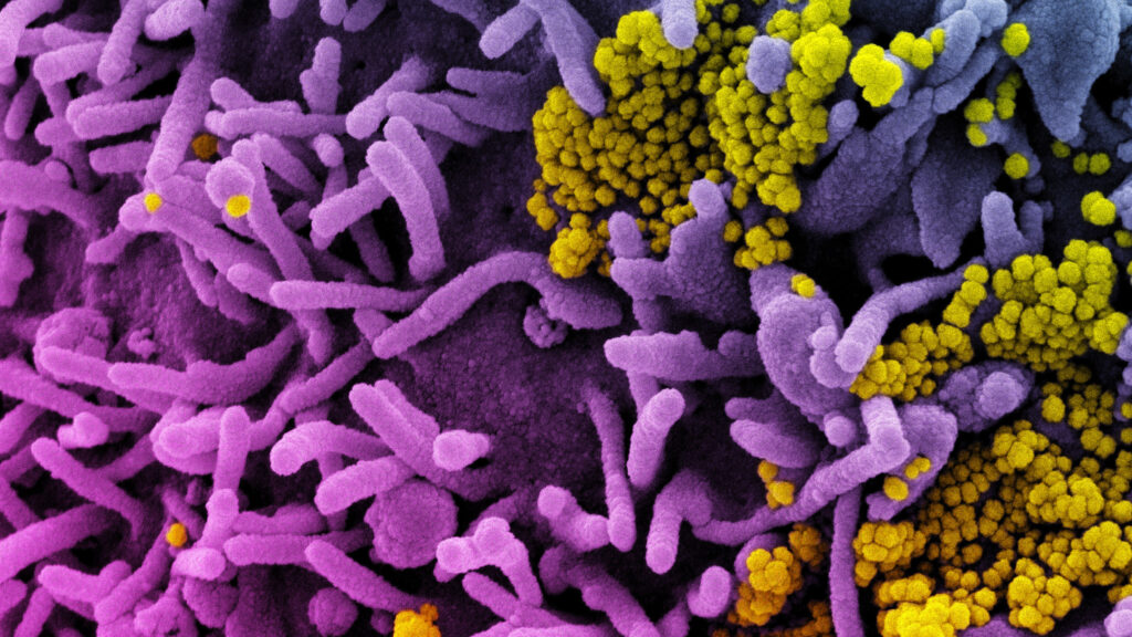 4 evolutionary scenarios for the coronavirus that causes Covid-19 | STAT