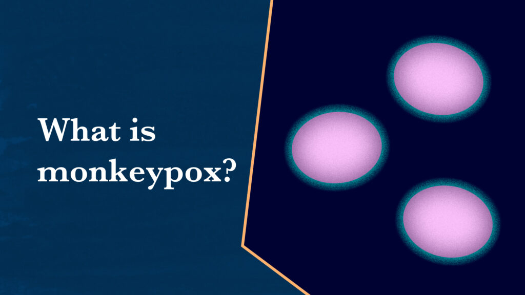 As an outbreak grows, what is monkeypox and how does it spread? | STAT