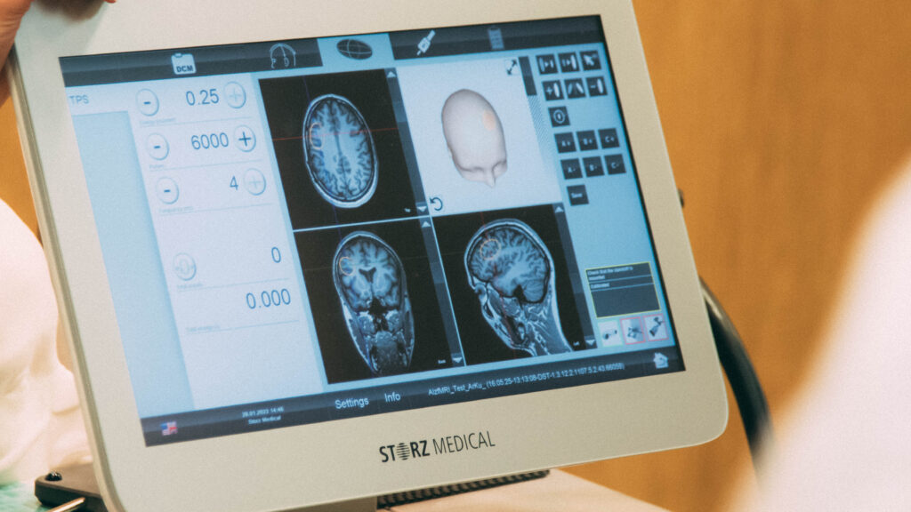 Pricey Alzheimer’s therapy used globally has limited evidence to back it up