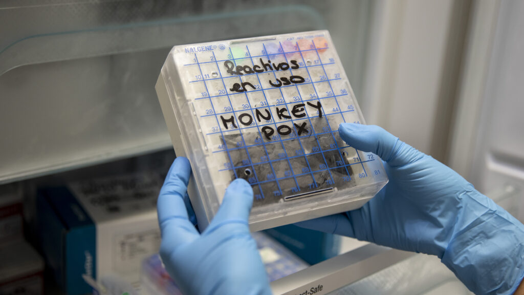 'Testing bottleneck' for monkeypox puts control at risk, experts warn | STAT