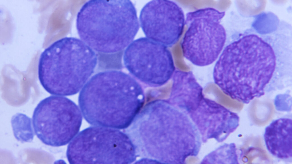 At ASH, positive news for Terns, Kura leukemia treatments | STAT