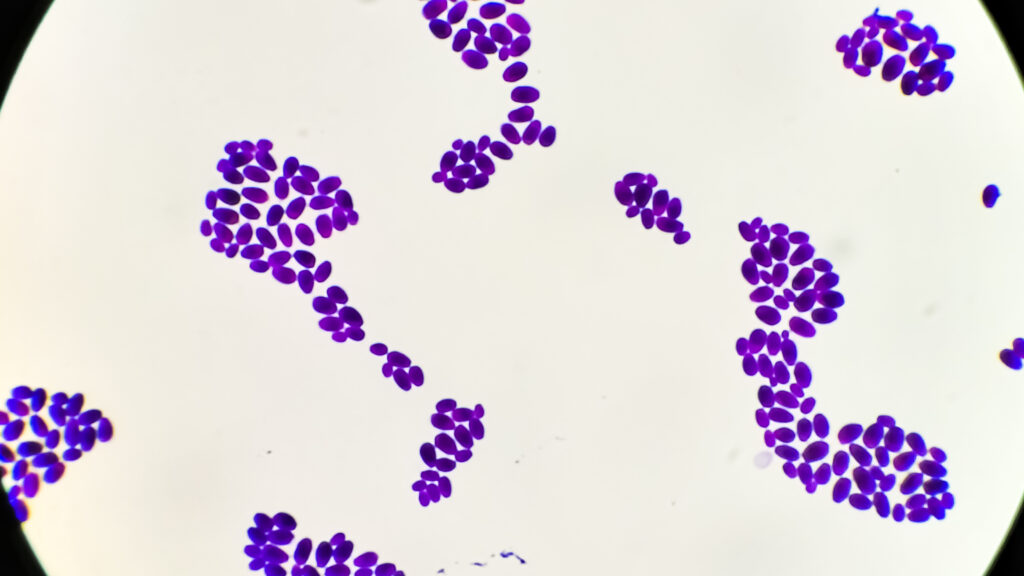 Candida auris and the threat of drug-resistant fungi | STAT