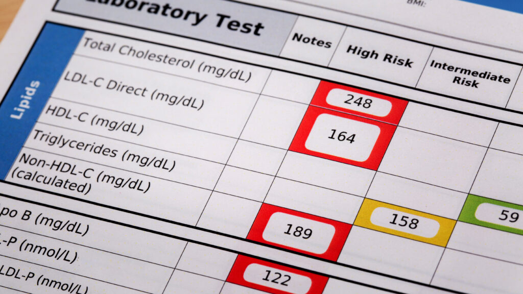 Heart attack and stroke risk calculators need revising | STAT