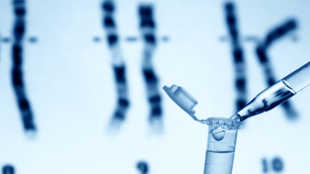 People with Down syndrome should be part of Alzheimer's trials