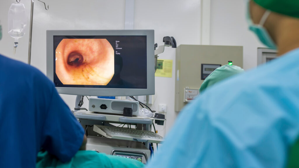 Colonoscopy prep: Liquid-only diets unnecessary, GI doctor says