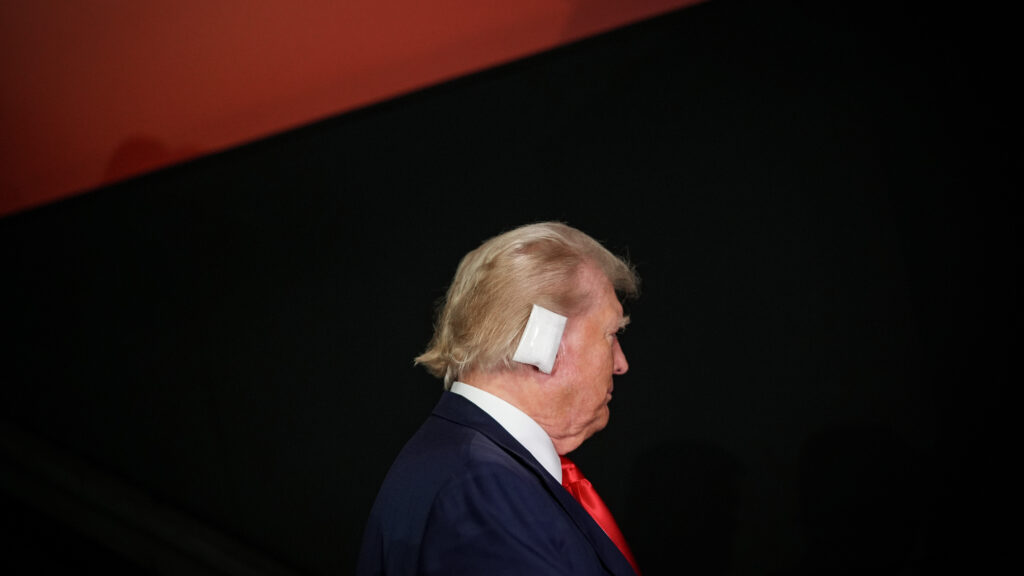 Trump ear injury: Gunshot trauma experts offer general assessment